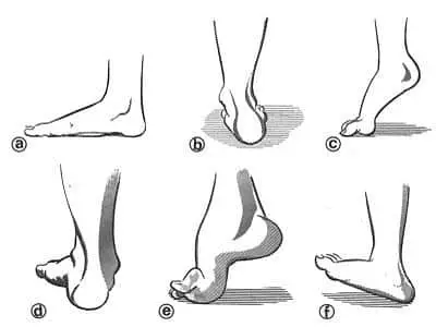 Dime que pie tienes y te diré donde te lesionarás al correr 7 Dime que pie tienes y te diré donde te lesionarás al correr 1