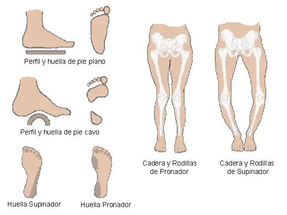 Dime que pie tienes y te diré donde te lesionarás al correr 8 Dime que pie tienes y te diré donde te lesionarás al correr 3