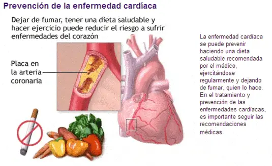 Factores de Riesgo Cardiovascular 6 Enfermedad Cardiovascular